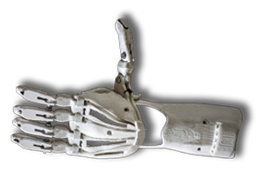 3D-Druck-Medizine-prothese-arm
