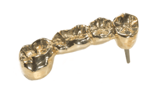 3D gedruckte gold Gebiss