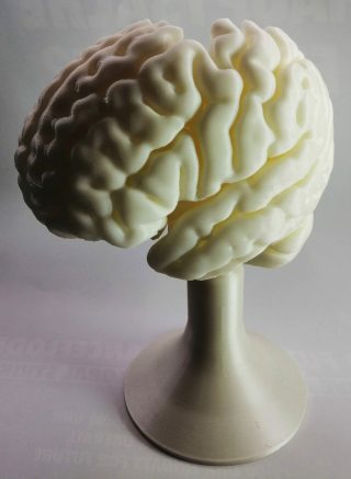 3D-Druck-Projekt Charité Gehirn