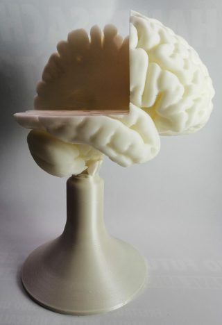 3D-Druck-Projekt Charité Gehirn