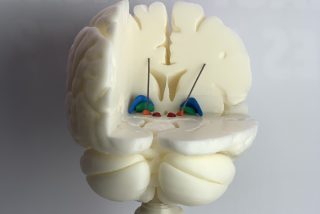 3D-Druck-Projekt Charité Gehirn