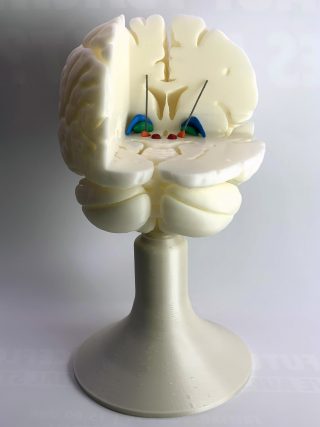 3D-Druck-Projekt Charité Gehirn