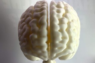 3D-Druck-Projekt Charité Gehirn