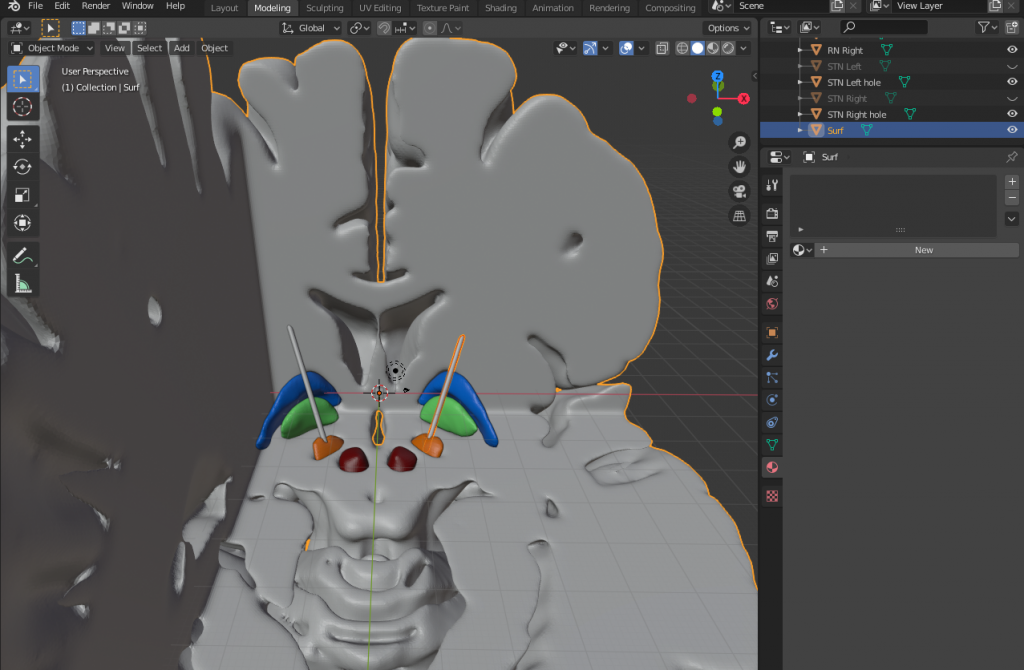 3D-Druck-Projekt Charité Gehirn