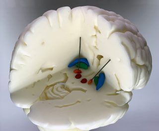 3D-Druck-Projekt Charité Gehirn
