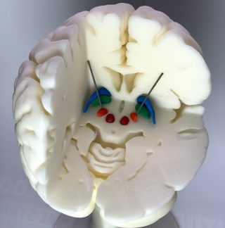 3D-Druck-Projekt Charité Gehirn